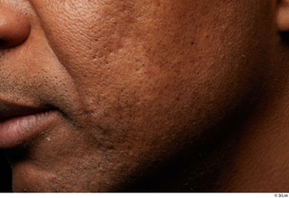 HD Face skin references Tiago cheek skin pores skin texture…